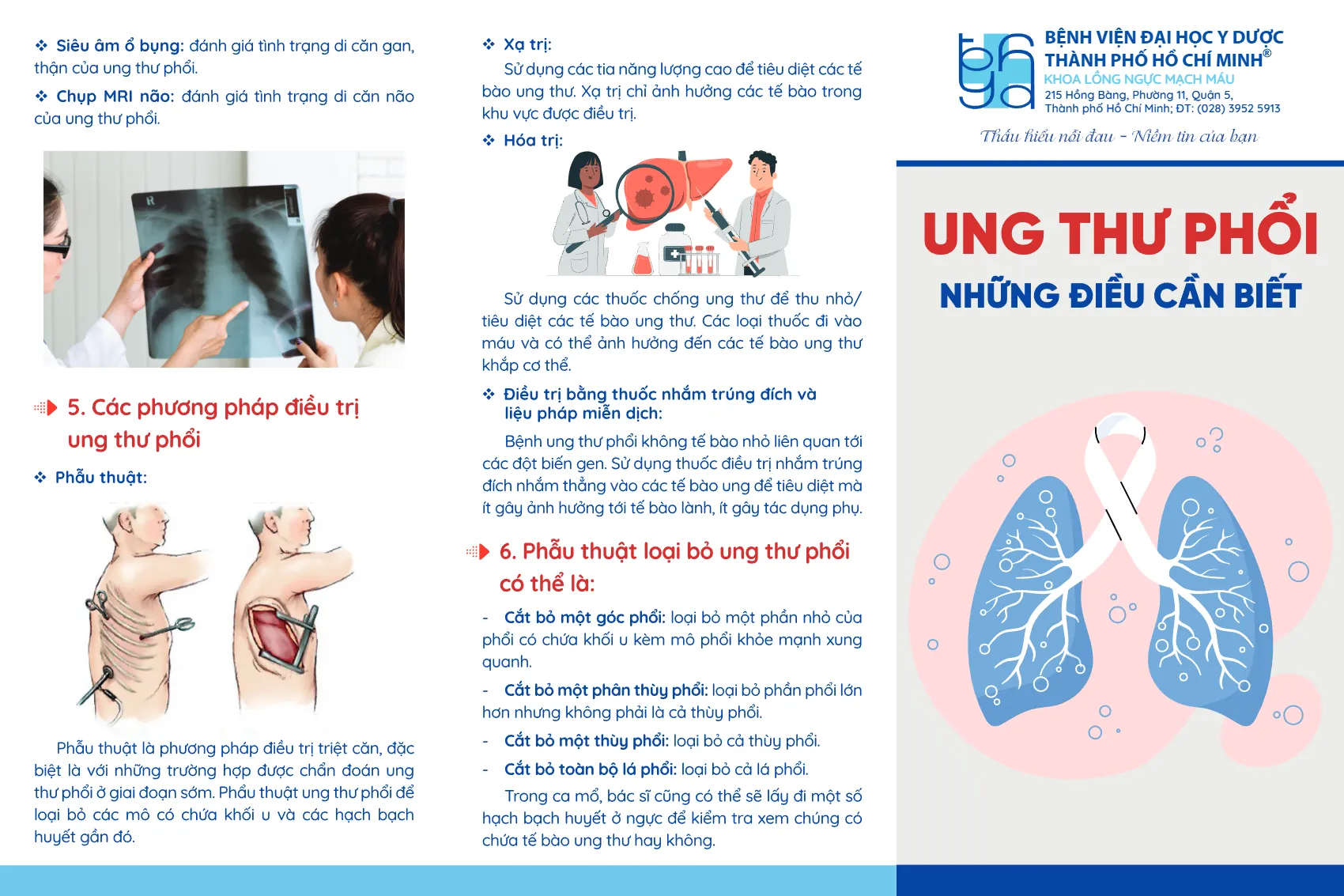 to roi ung thu phoi nhung dieu can biet_1.webp